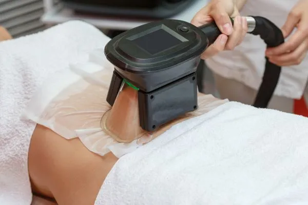 Image of person having fat freezing treatment to help weight gain Bridgnorth