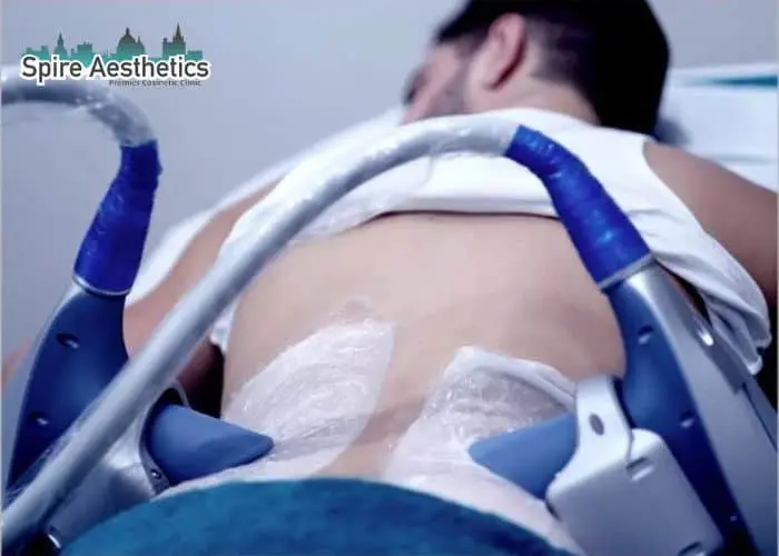 Man having fat freezing treatment done on love handles before a competitions Bridgnorth to create a sculpted look.