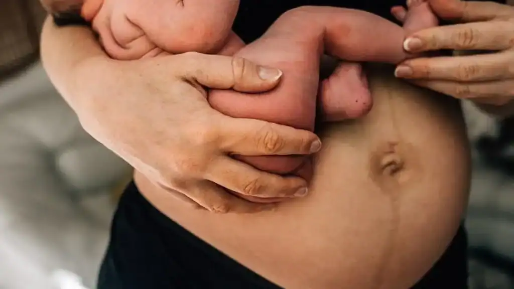Why Is My Stomach Still Big After Pregnancy Bridgnorth?